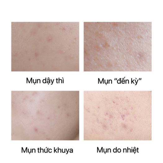 TUTA - Serum Oligopeptide Essence giảm mụn Lucenbase, Tinh chất dưỡng da kiểm soát nhờn, thu nhỏ lỗ chân lông 30ml