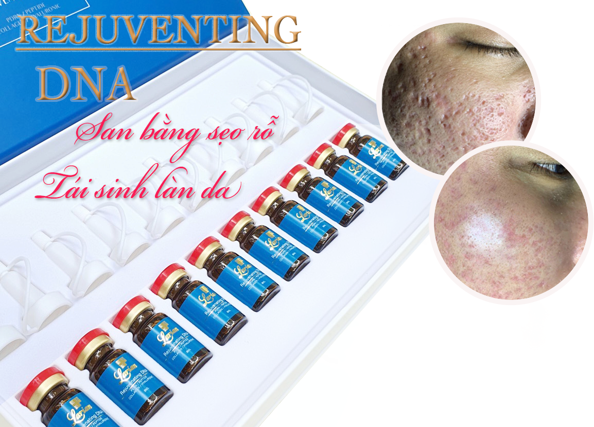 Dna rejuvenating serum ( tế bào gốc trị sẹo rỗ, phục hồi tái tạo da chuyên dùng sau lăn kim, laser...)
