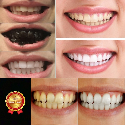 Than hoạt tính trắng răng SMILE UP loại bỏ ố vàng - thơm miệng 100G
