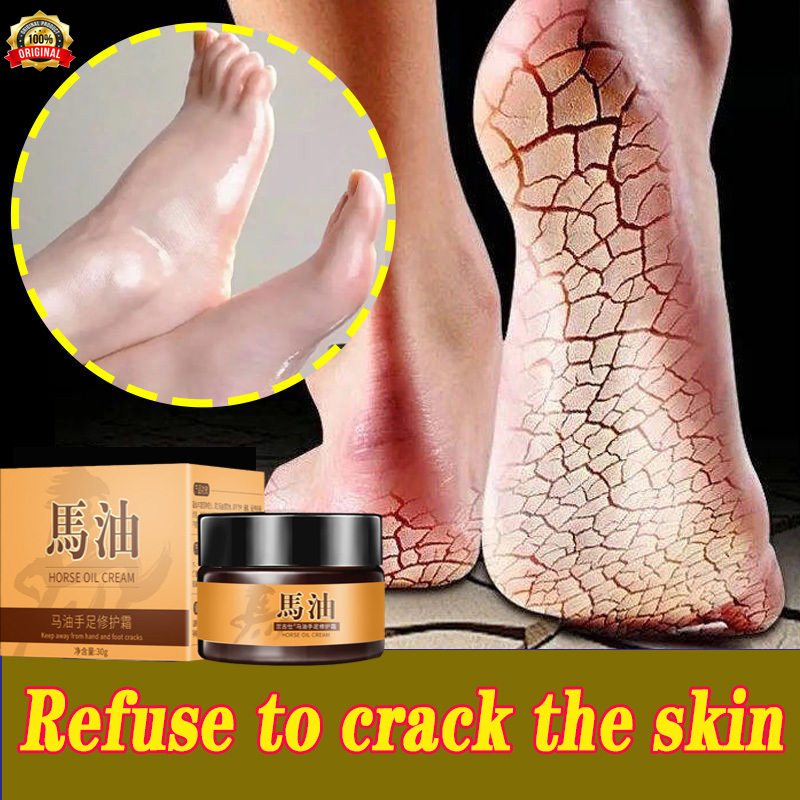 Gambar Hand Foot Anti cracking Cream Anti Drying Crack Foot Cream 50g Horse Oil Hand and Foot Cracked Heel Dry Cracked Heel Cracked Anti Cracked Cracked Open Foot Care Healing Cream Removal Dead Skin Hand Feet Care