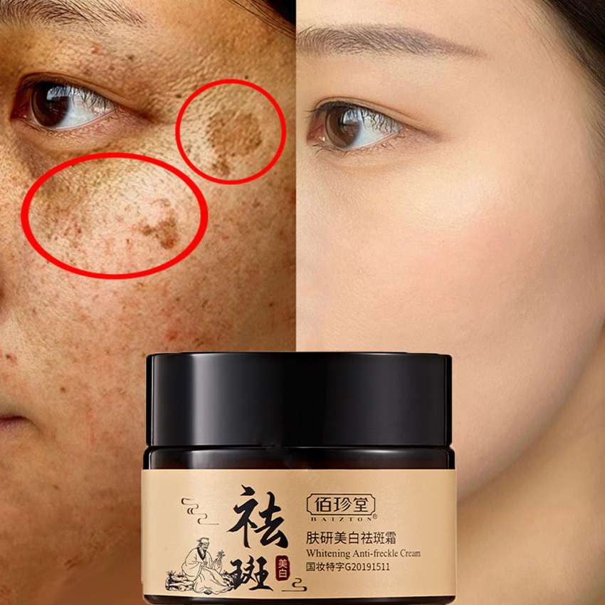 Kem xóa tàn nhang kem làm trắng da xóa vết thâm nám tàn nhang vết chân chim đồi mồi săn chắc da làm mờ hắc tố Ẩm Làm Sáng Da Làm mờ tàn nhang hiệu quả
