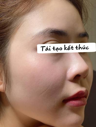 Tái tạo da Cổ Mộc Lan 50ml