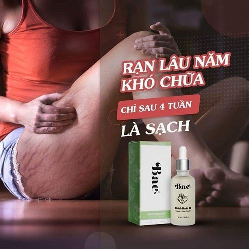 Chai tinh dầu rạn da bae hàn quốc loại 50ml/1 chai-