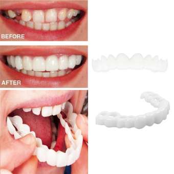 Răng giả hàm trên/hàm dưới linh hoạt thoải mái cho nụ cười tươi hoàn hảo - INTL