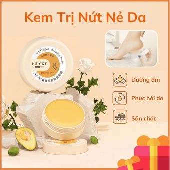 Kem Dưỡng Ẩm Nẻ Gót Chân Heyxi, Kem Ngăn Ngừa Phục Hồi Nứt Nẻ Gót Chân, Nứt Nẻ Tay, Nứt Nẻ Môi Hiệu Quả