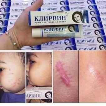 Kem tri sẹo KJINPBNH Nga