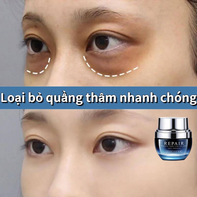 Kem mắt dưỡng mắt kem mắt chống lão hóa Loại bỏ quầng thâm mắt Kem dưỡng ẩm vùng mắt kem chống nhăn 38g loại bỏ bọng mắt nâng cơ làm săn chắc xóa mờ nếp nhăn chống lão hóa phù thũng