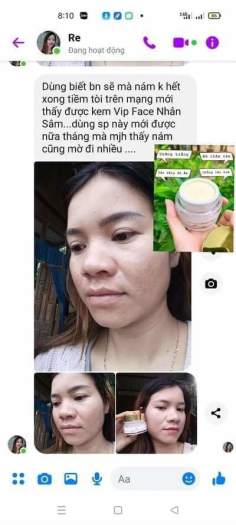 Kem VIP FACE NHÂN SÂM (MẪU MỚI PHIÊN BẢN 2021) giúp đánh bay nám tàn nhang trắng da ngừa lão hóa TẶNG BĂNG ĐÔ +GẤP TÓC