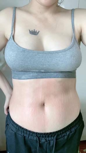 Tan Mỡ Bụng Giảm Mỡ Bụng Cao Lá Nóng Gia Truyền Tặng kèm Mủ ủ nóng