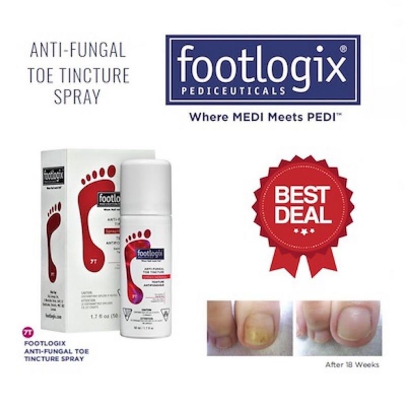 Footlogix At Home Foot File - 1 Piece Footfile with Footlogix Logo