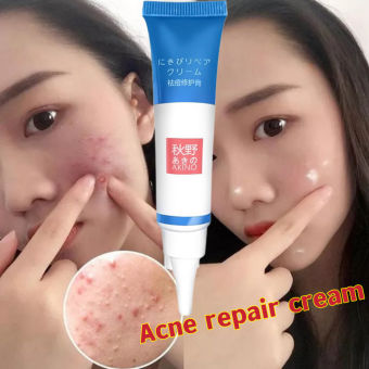 Kem mụn AKINO- Gel giảm mụn giảm thâm,làm mờ vết thâm mụn, làm dịu và dưỡng ẩm cho da12g