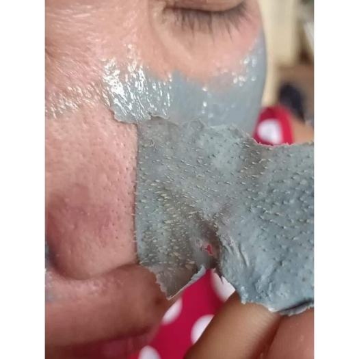 Gel Lột Mụn DR.ACNE - Hút sạch mụn cám, mụn đầu đen