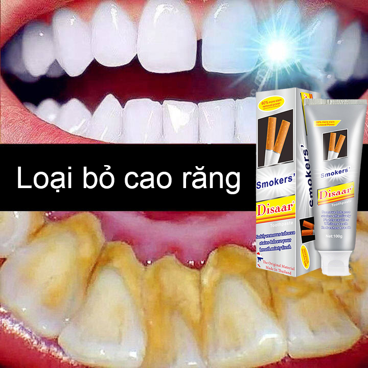 [HCM]Kem đánh răng Disaar100g dành cho người hút thuốc, bảo vệ lợi chắc khỏe, không bị chảy máu chân răng