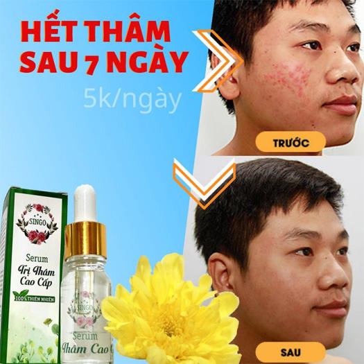 Serum trị thâm Singo cao cấp