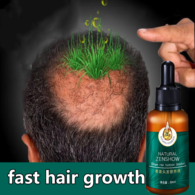 Gambar Ginger Hair Oil 30ml promote hair growth Anti hair loss Stabilize hair roots dense growth essence Repair damaged hair Serum Hair Care for Men and Women