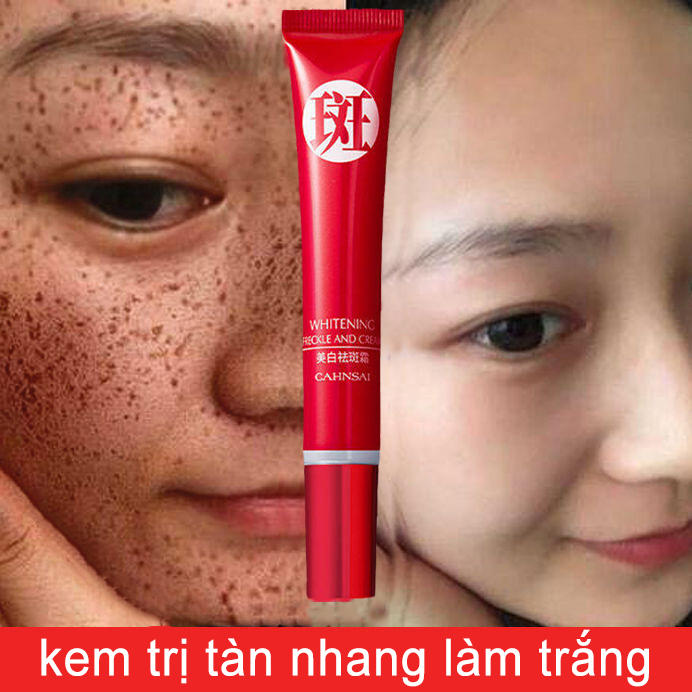 (7 ngày hết tàn nhang) Kem trị tàn nhang trắng da, phá vỡ sắc tố, xóa vết thâm, nám, dưỡng ẩm, làm sáng đều màu da, phục hồi làn da tươi trẻ và mịn màng, unisex