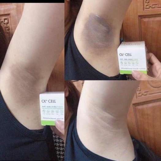 Kem Hút Thâm Hàn Quốc OL CELL