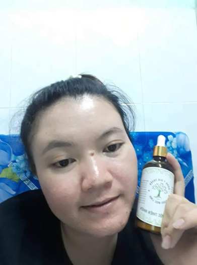 Đông y gia truyền Thảo Mộc Linh tái tạo da