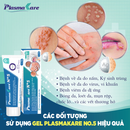 Gel bôi Nano Bạc PlasmaKare No5 kháng khuẩn, kháng nấm, virus...chống viêm, giảm ngứa, tái tạo da, chuyên sâu cho bệnh về da