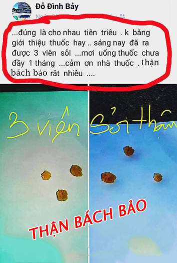 Thận Bách Bảo - Hỗ trợ tiêu trừ Sỏi Thận, Sỏi Mật (1 tháng 4 Hộp)