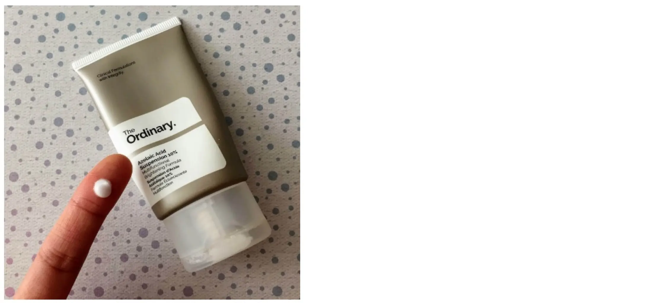 azelaic acid skincare